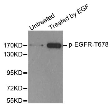 EGFR Antibody (phospho-Thr678)