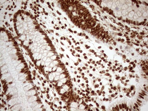 Monoclonal Mouse anti-Human ALOX5 / 5-LOX Antibody (clone OTI3F1, aa18-364, IHC, WB)
