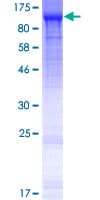 Human MOCOS / MoCo Sulfurase Protein (Recombinant GST)