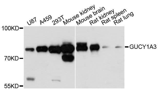 GUCY1A1 / GUCY1A3 Antibody