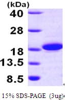 Human ACOT13 / THEM2 Protein (Recombinant His)