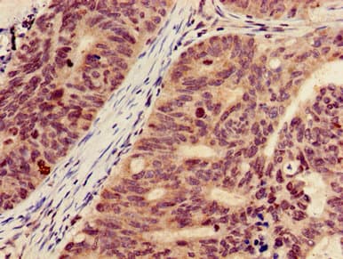 HIST1H3A Antibody