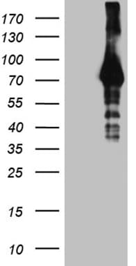 HABP2 Antibody (aa33-330, clone OTI4G9)