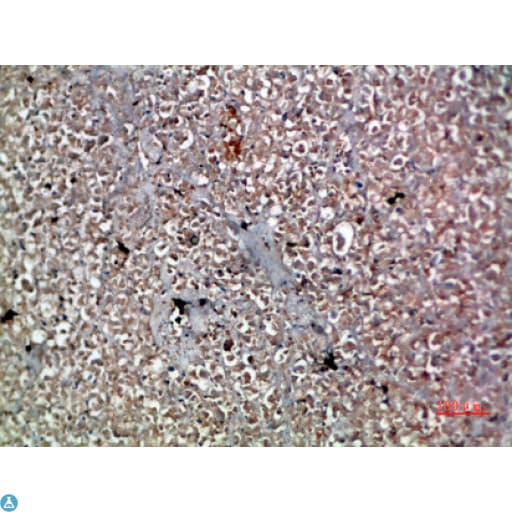 IL20 Antibody