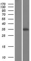 CHORDC1 / CHP1 Protein (Over-Expression Lysate Myc-DDK (Flag))
