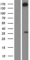 WDR62 Protein (Over-Expression Lysate Myc-DDK (Flag))