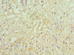 LMOD1 Antibody (aa29-187)