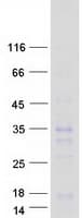 Human HOXB6 Protein (Recombinant Myc-DDK (Flag))