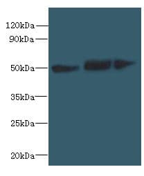 Polyclonal Rabbit anti-Human SLC25A46 Antibody (WB)