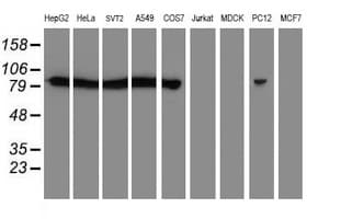 IHC-plus™ CAPN2 / Calpain 2 / M-Calpain Antibody (clone 1F4)