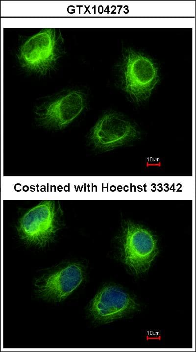 INPP5F Antibody (aa593-904)