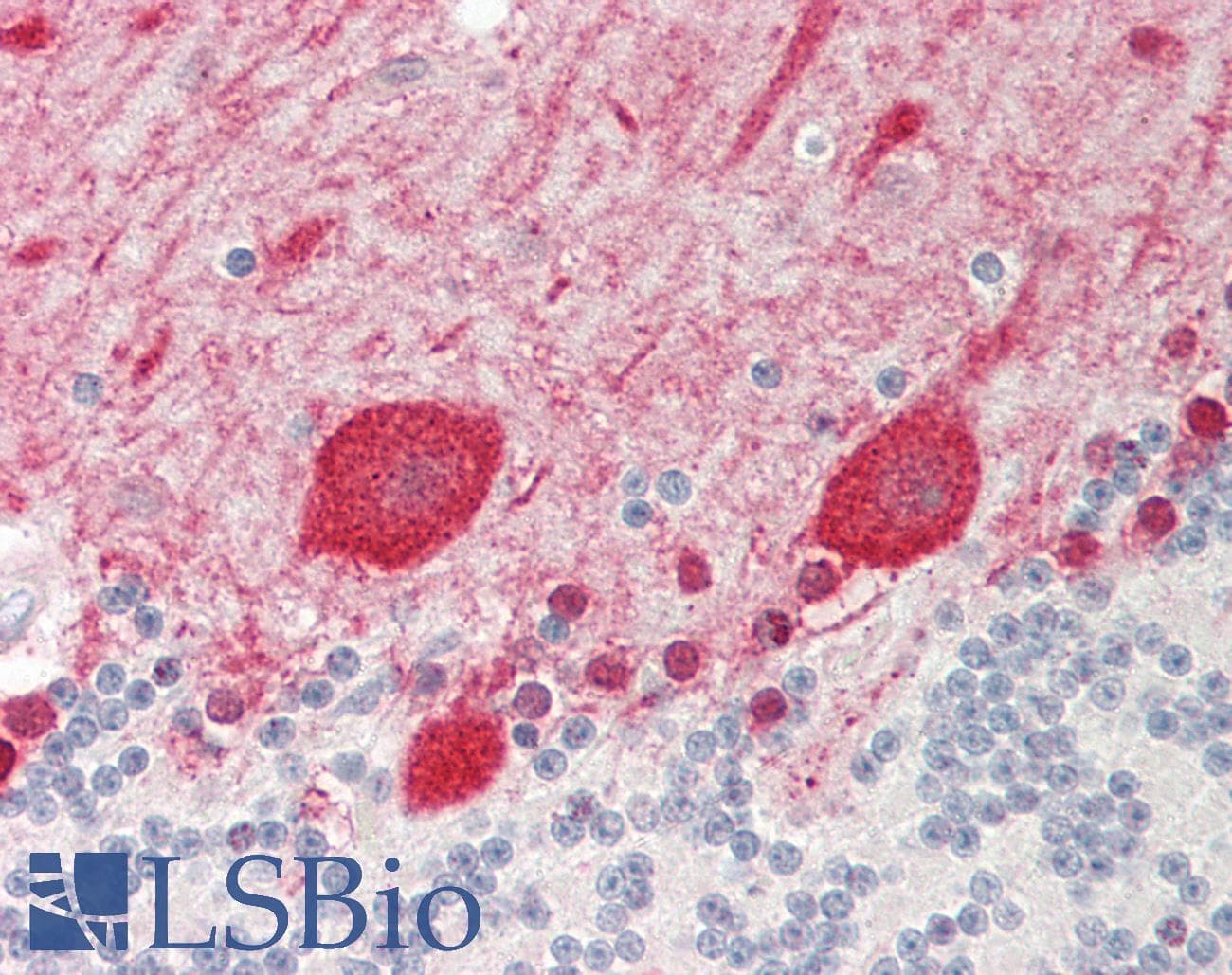 IHC-plus™ DCK / Deoxycytidine kinase Antibody