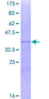 Human MAGEF1 Protein (Recombinant GST, N-terminus)