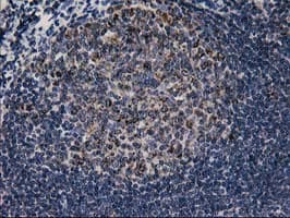 CCM2 / Malcavernin Antibody (clone OTI1E9)