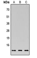 Polyclonal Rabbit anti-Human XTP4 / C17orf37 Antibody (C-Terminus, WB)