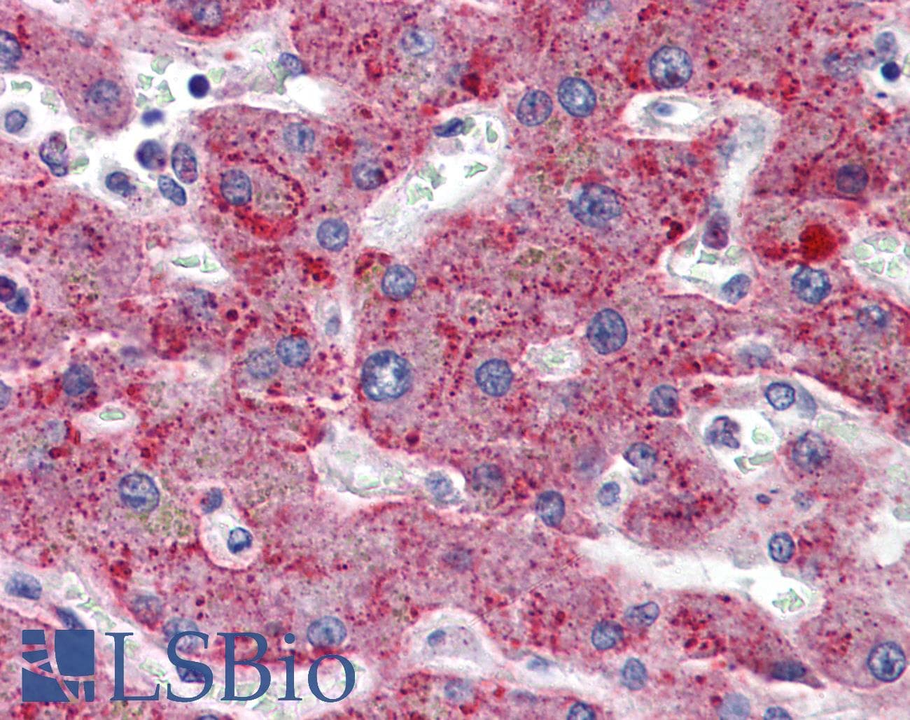 IHC-plus™ Monoclonal Mouse anti-Human SERPING1 / C1 Inhibitor Antibody (clone 3F4-1D9, IHC, WB)