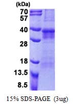 Human OSCAR Protein (Recombinant His)