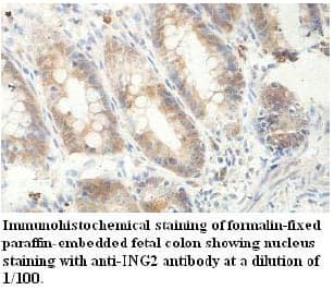 ING2 Antibody (aa22-200)