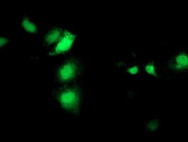 IHC-plus™ SEC14L2 Antibody (clone 4H2)