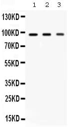 AGO2 / EIF2C2 Antibody