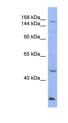 MNK / ATP7A Antibody (aa1403-1452)