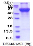Human UQCRC1 Protein (Recombinant His)