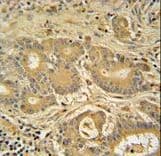 IMMT / Mitofilin Antibody (aa700-729)