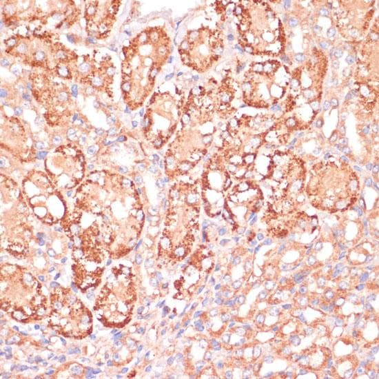 MAP2K3 / MEK3 / MKK3 Antibody