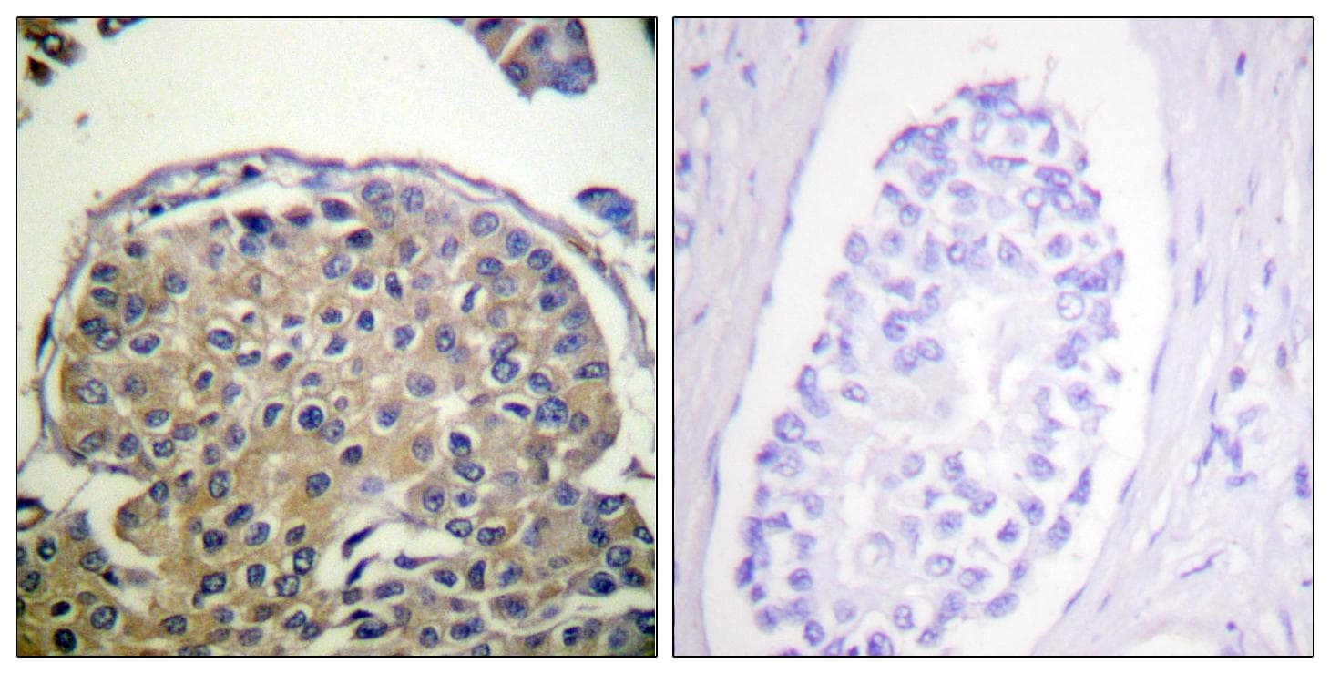 EMA / MUC1 Antibody (phospho-Tyr1243)