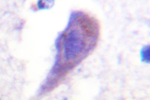 Polyclonal Rabbit anti-Human HRS / HGS Antibody (Leu330, IHC, IF, WB)