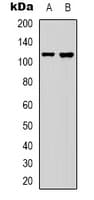 Polyclonal Rabbit anti-Human COL19A1 / Collagen XIX Antibody (Internal, WB)