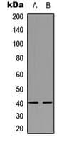 DLX3 Antibody (Internal)