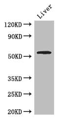 SLC18A1 / VMAT1 Antibody