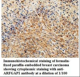 ARFGAP1 Antibody (aa11-204)