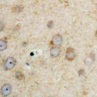 SPHK2 Antibody (C-Terminus)