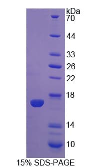 Pig IL5 Protein (Recombinant His)