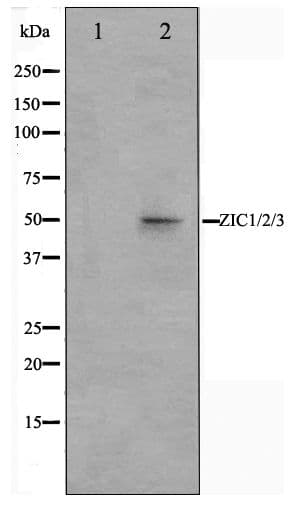 Polyclonal Rabbit anti-Human ZIC1+2+3 Antibody (IHC, WB)