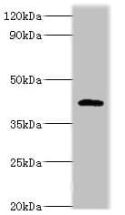 PARL / PSARL Antibody (aa1-170)