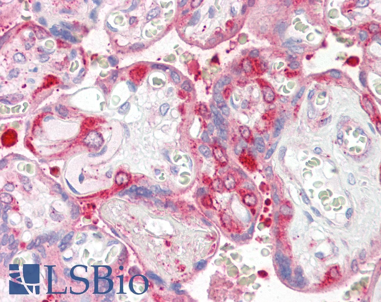 IHC-plus™ Polyclonal Rabbit anti-Mouse RPS6KA3 / RSK2 Antibody (C-Terminus, IHC, WB)