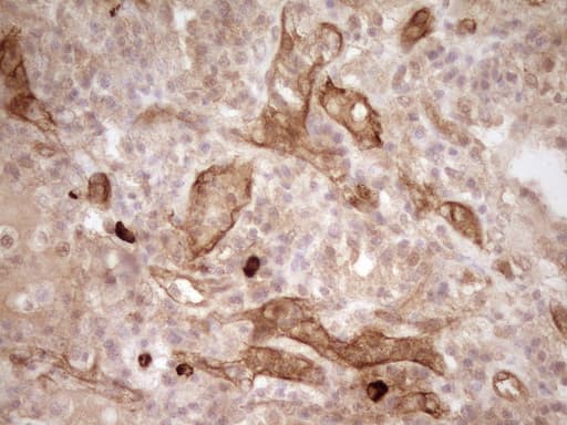 PROCR / EPCR Antibody (aa1-210, clone UMAB201, Carrier-free)
