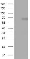 Monoclonal Mouse anti-Human NUMB Antibody (clone OTI4D10, aa1-365, WB)