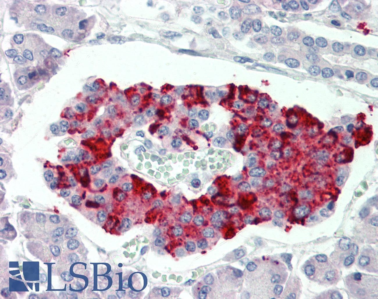 IHC-plus™ SCUBE3 Antibody