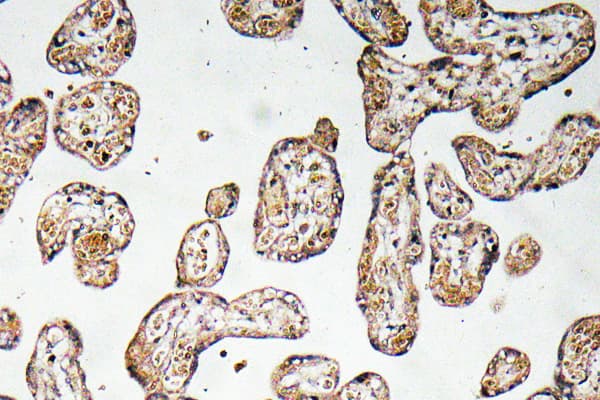 Polyclonal Rabbit anti-Human GCLM Antibody (aa42-91, IHC, WB)