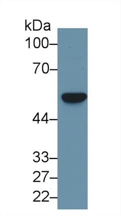 FSCN1 / Fascin Antibody (aa8-260, PE)
