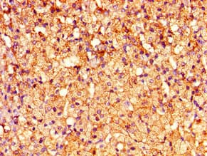 CRHR2 / CRF2 Receptor Antibody