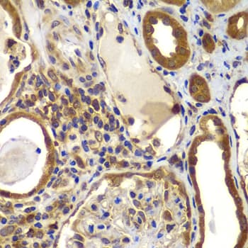 NME2 Antibody