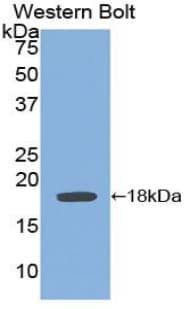 IL6ST / CD130 / gp130 Antibody (aa606-756)