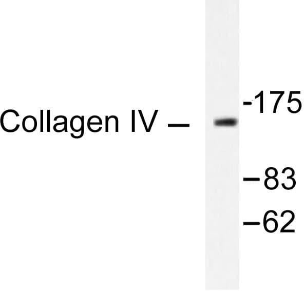 Polyclonal Rabbit anti-Human COL4A1 / Collagen IV Alpha1 Antibody (Gly46, IHC, WB)