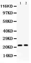 Polyclonal Rabbit anti-Human IL18 Antibody (aa37-193, IHC, WB)
