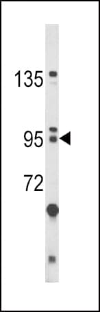 BICC1 Antibody (aa80-107)